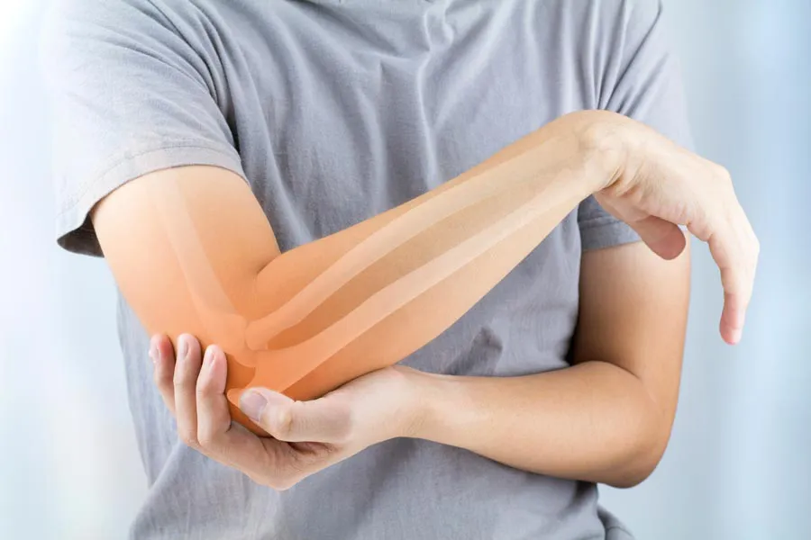 Osteoporosis-Doctor A close-up of a woman holding her elbow with an illustration of the bones and joint experiencing pain from osteoporosis. Get osteoporosis treatment from Proactive Wellness Centers in Loudoun County.
