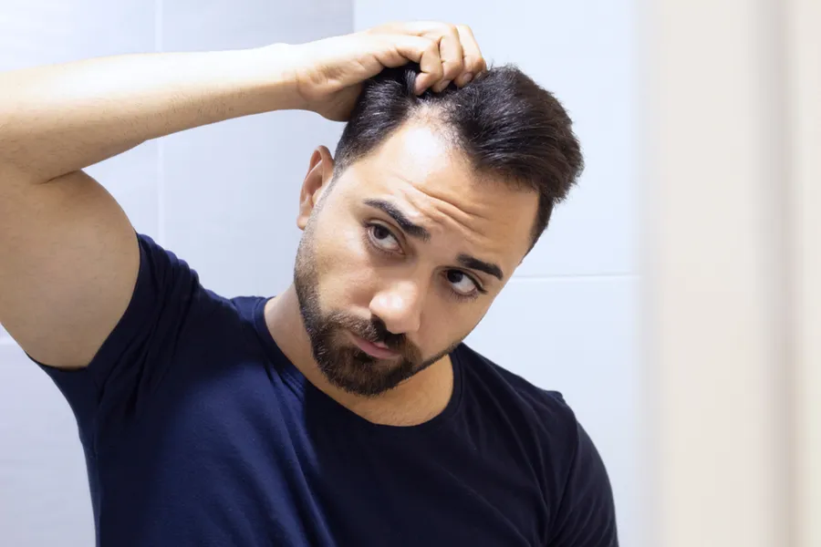 PRP-for-Hair-Loss-Doctor A man in a navy t-shirt looks in the mirror worrying about and touching his receding hairline, considering PRP for hair loss and restoration treatment from Proactive Wellness Centers in Loudoun County.
