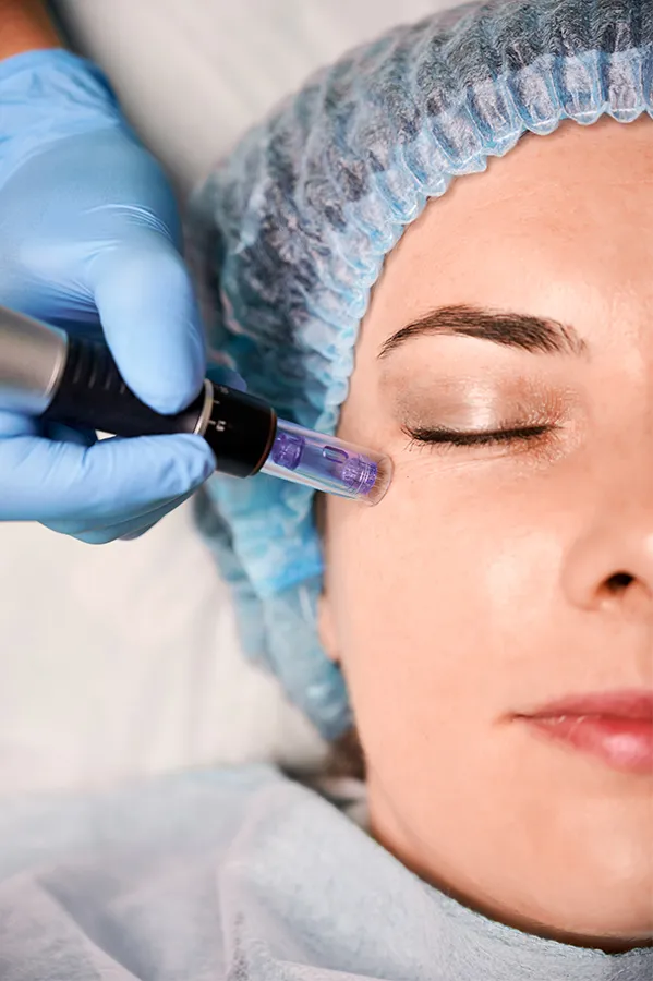Peptides-for-Skin-and-Aesthetics-Treatment A woman receiving peptide therapy to her face. Get peptides for Skin and Aesthetics from Proactive Wellness Centers in Loudoun County.